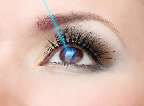 Cirurgia a laser nos olhos em Curitiba